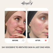 Egyptian recovery cream -Deep Nourishment for a Stronger Skin Barrier.