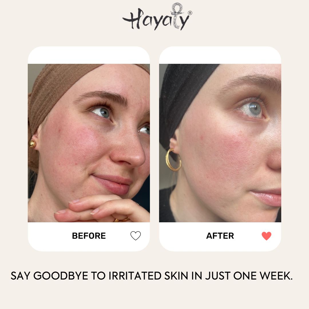 Egyptian recovery cream -Deep Nourishment for a Stronger Skin Barrier.